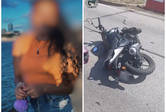 Joven de 21 años iba a trabajar en moto, cayó y un camión le arrolló una de sus piernas