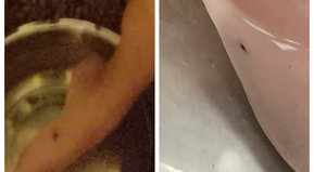 Desgracia con suerte