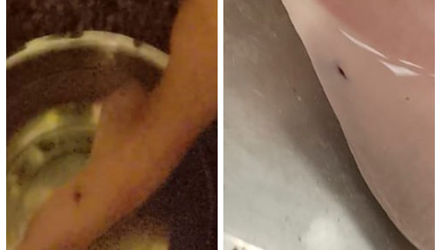 Desgracia con suerte