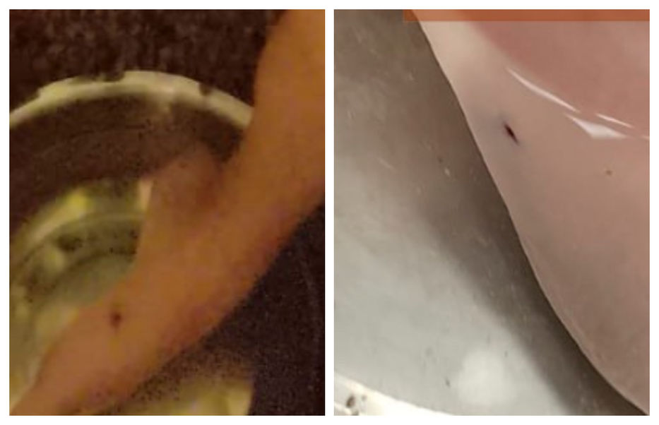 Desgracia con suerte