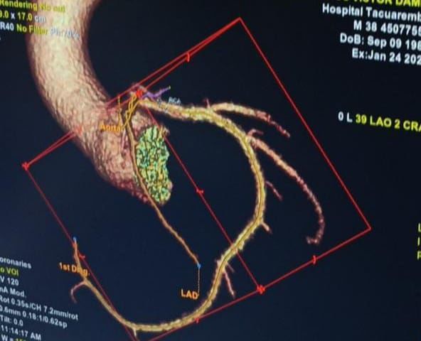 Hospital de Tacuarembó