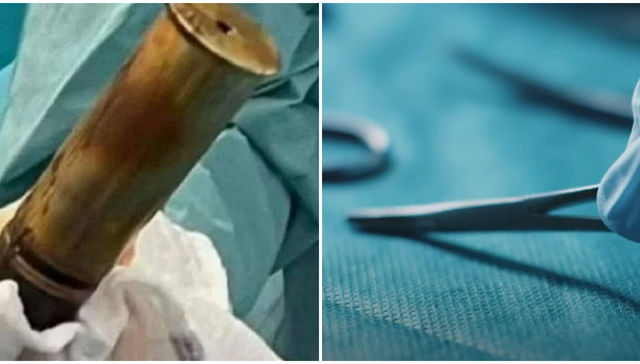 Con novedad en el frente