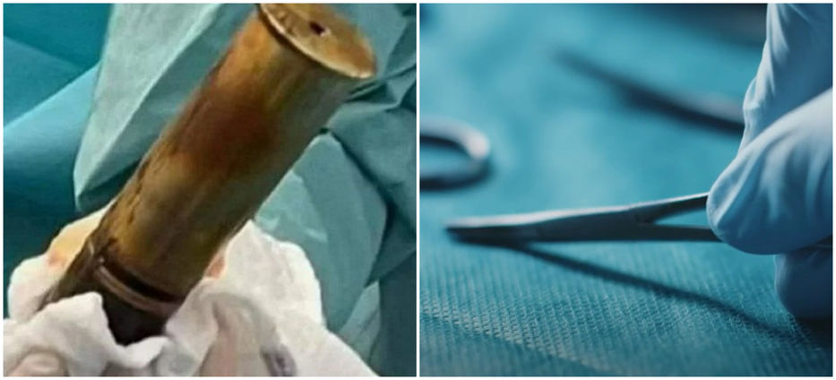 Con novedad en el frente