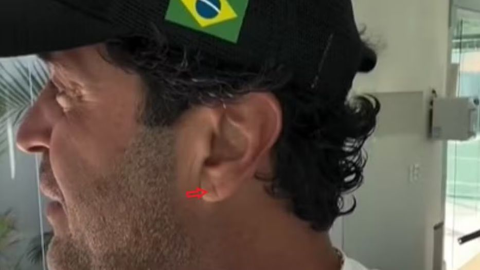 Importante: este signo no es un diagnóstico, sino una posible señal de alerta que debe evaluarse&nbsp;junto con otros factores de riesgo.