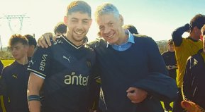 Sin pelos en la lengua