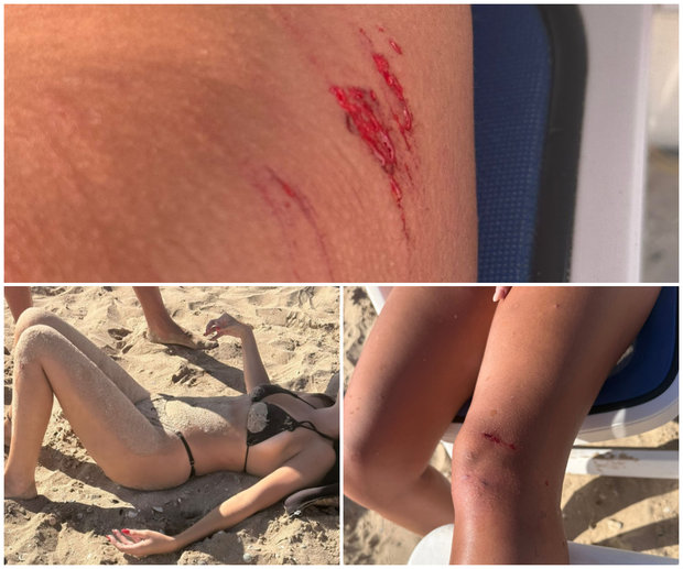 Dos jóvenes israelíes lesionadas en Punta del Este por chocar en motos de agua en la playa