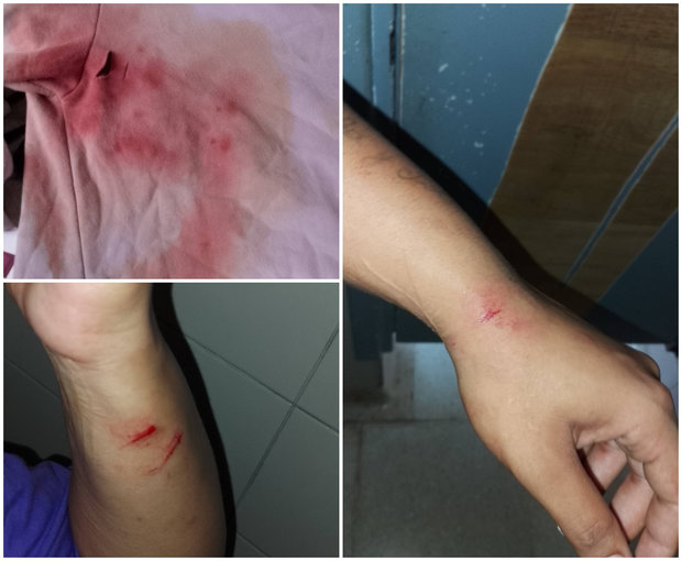 “Sola en la calle, desangrándome”: el relato de mujer apuñalada en el Centro de Montevideo