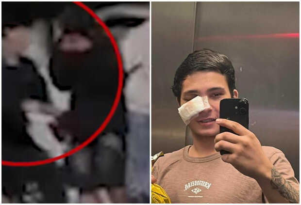 Dos condenados, uno de ellos militar, por pelea en la que joven de Artigas perdió un ojo