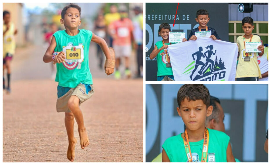 Aplauso, medalla y beso