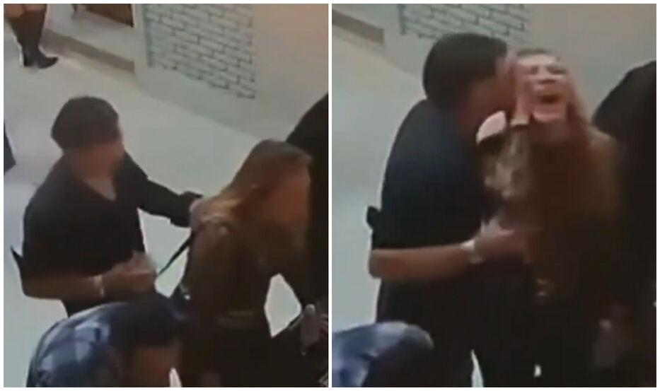 “Desfiguración permanente”: le arrancó una oreja a su novia y dijo que “fue sin querer”