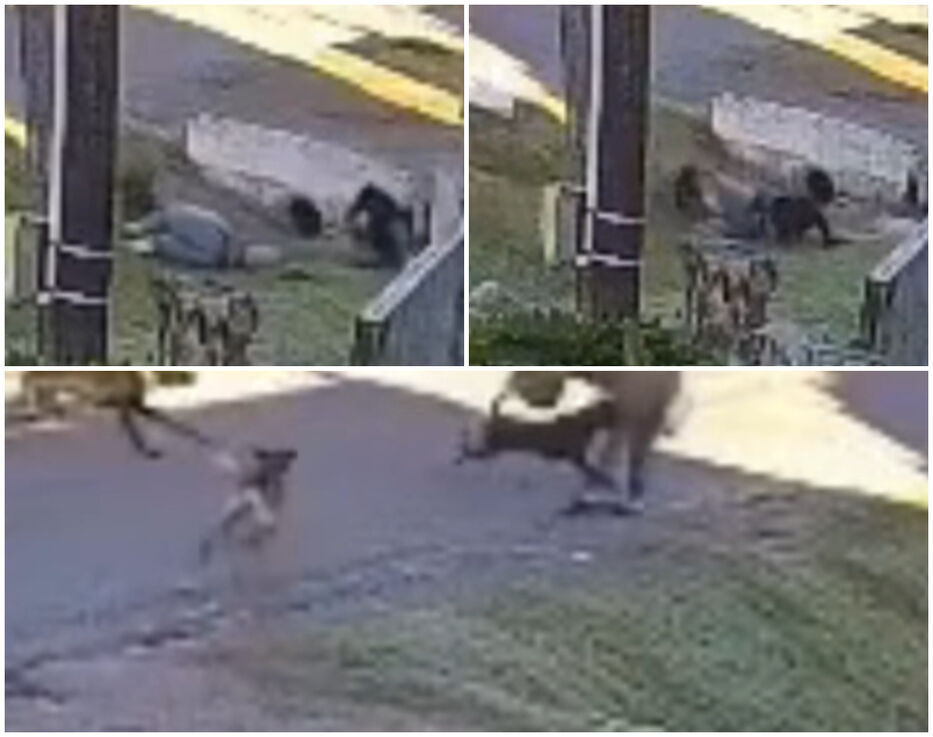 Brutal ataque de tres perros a una joven: se escaparon de una casa y la dejaron grave