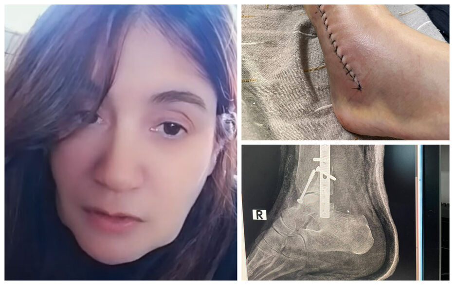 “Primaria se lava las manos”: maestra pide ayuda al quedar sin ingresos tras accidente