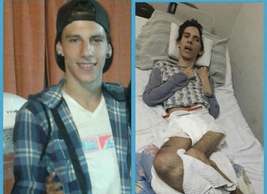 Dolor por la muerte de Leandro Ribeiro, joven parapléjico por trágico choque en Paysandú