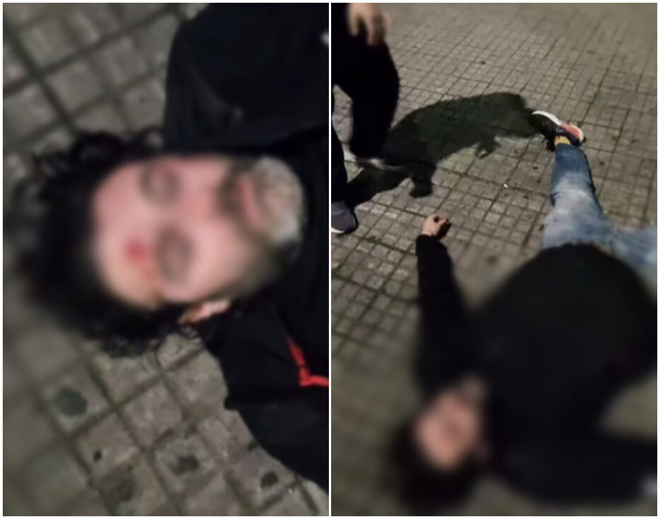 “Le partieron la cabeza”: encontraron a hombre semiinconsciente en plaza de los Bomberos
