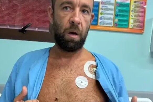Un pez espada atravesó el pecho de un surfista de 42 años en Costa Rica pero sobrevivió