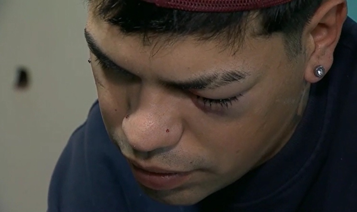 Habló el joven herido tras un operativo en el Parque Rivera: “El ojo está muy lastimado”