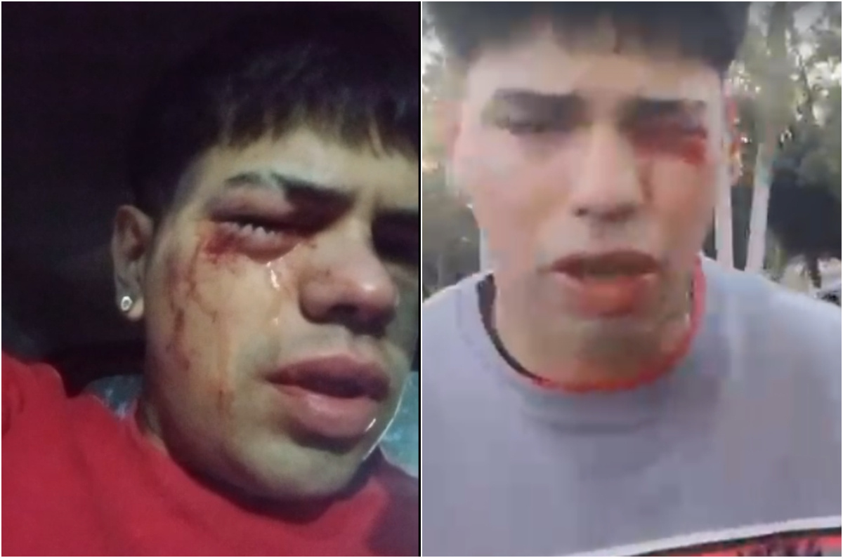 El periplo del chapista que perdió desde un ojo hasta su trabajo por un operativo policial