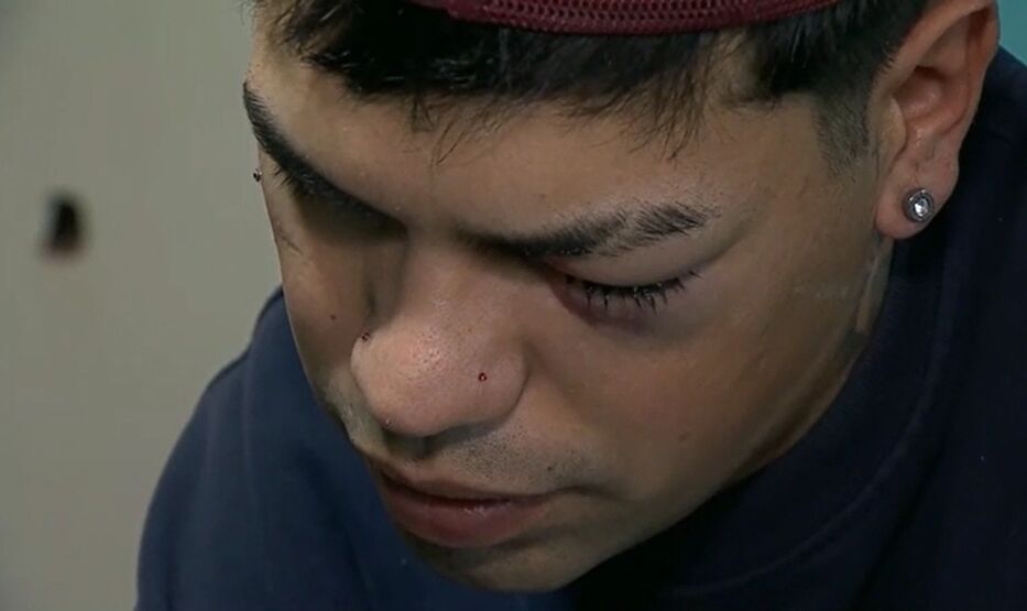 Habló el joven herido tras un operativo en el Parque Rivera: “El ojo está muy lastimado”