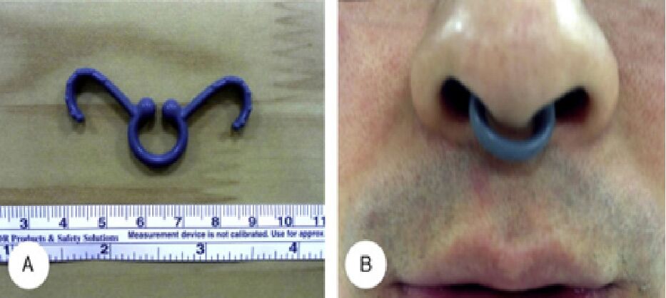 Stent nasal