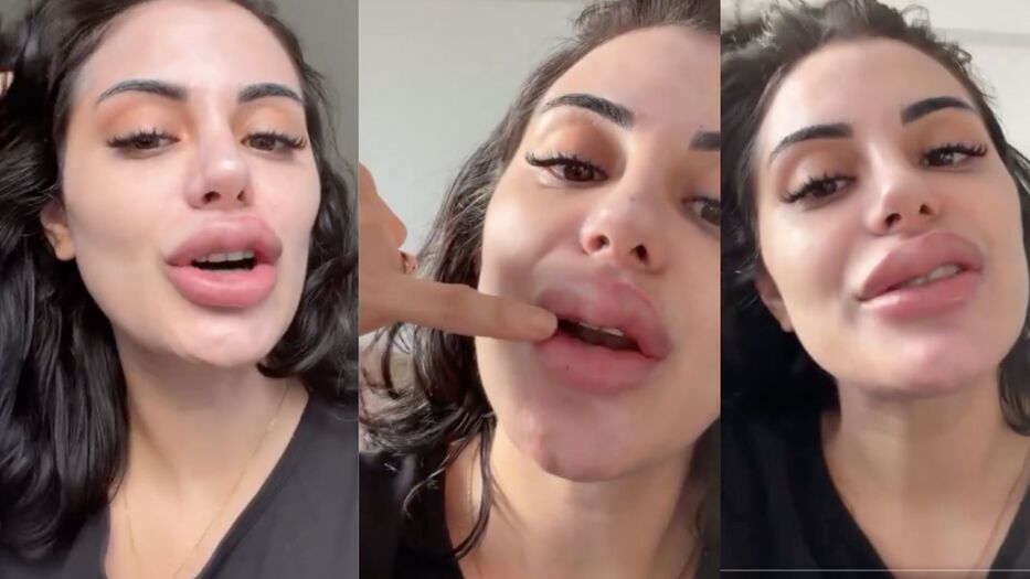Anto Pane se achicó los labios y viaja a España para un nuevo reality: “¿Cuándo se irán?”
