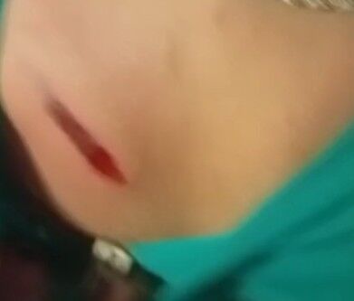 “Tenemos miedo”: niña de 12 años herida por una bala perdida que ingresó a su casa