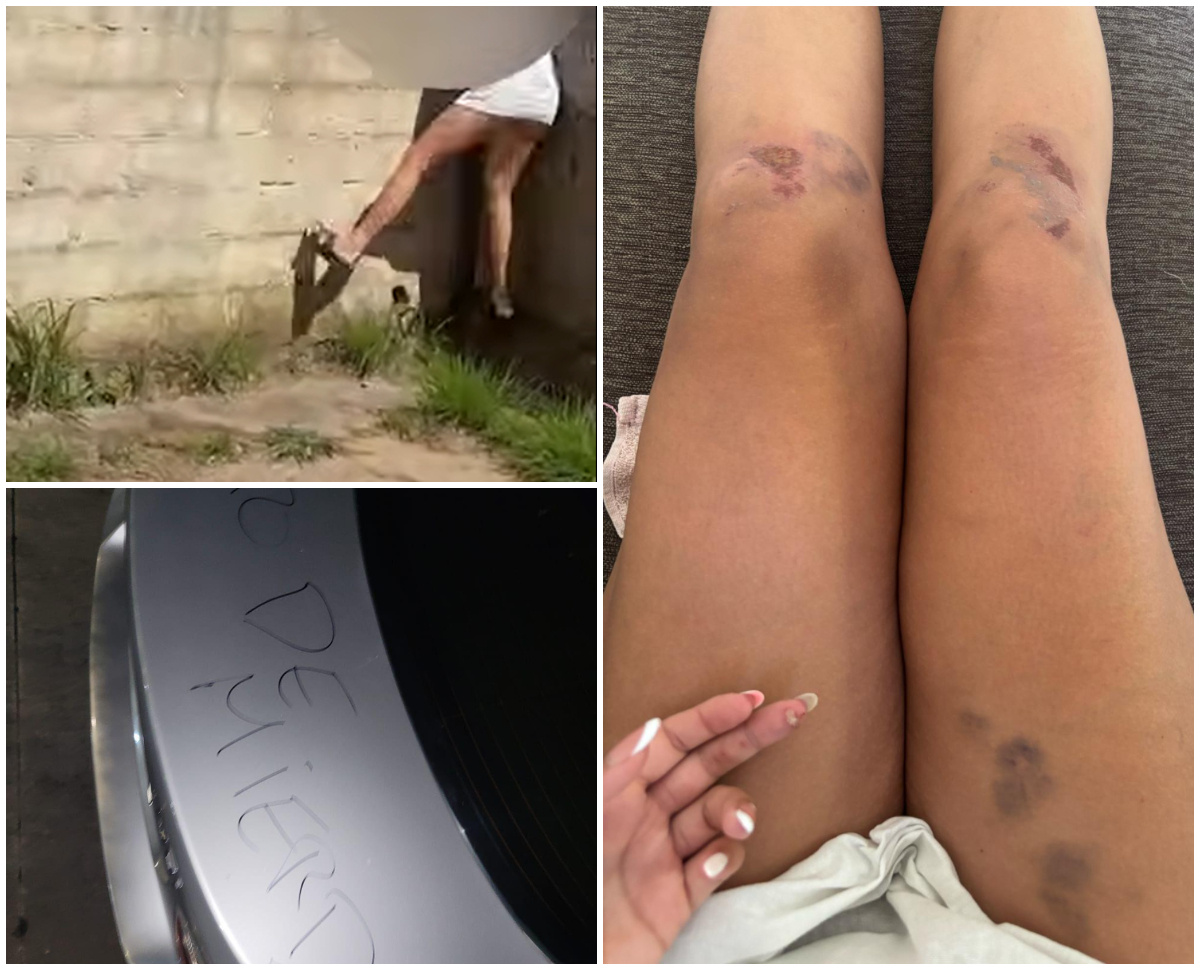 “Se está metiendo”: denuncian a una mujer por golpiza con rastrillo en casa de su expareja