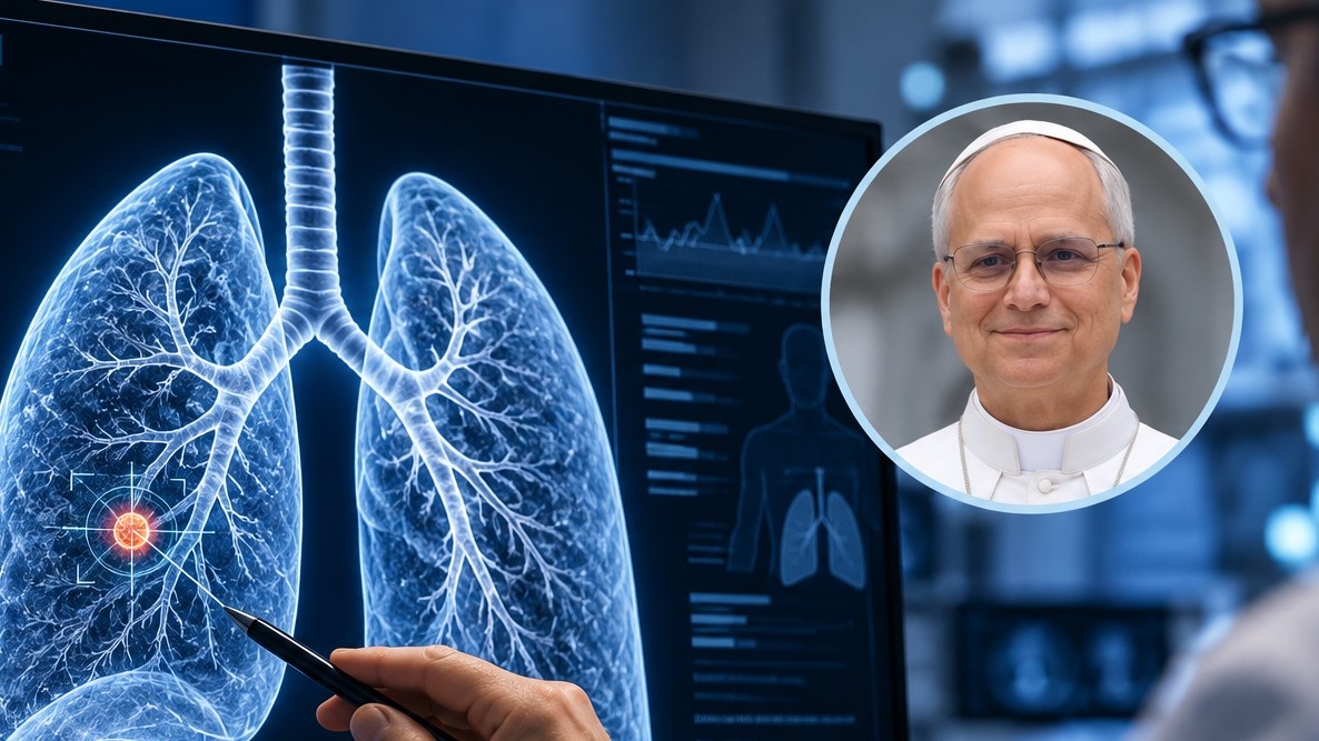 León XIV será operado de un nódulo pulmonar: qué se sabe sobre la lesión de 3 milímetros