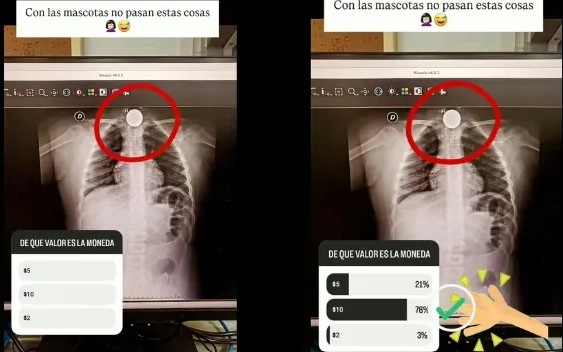 “Con las mascotas no pasa”: enfermera filtró radiografía de niña de 7 años en Instagram