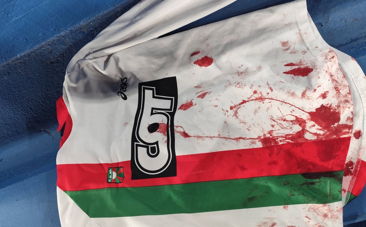 Hinchas de Deportivo Maldonado denunciaron botellazos desde la tribuna de Nacional