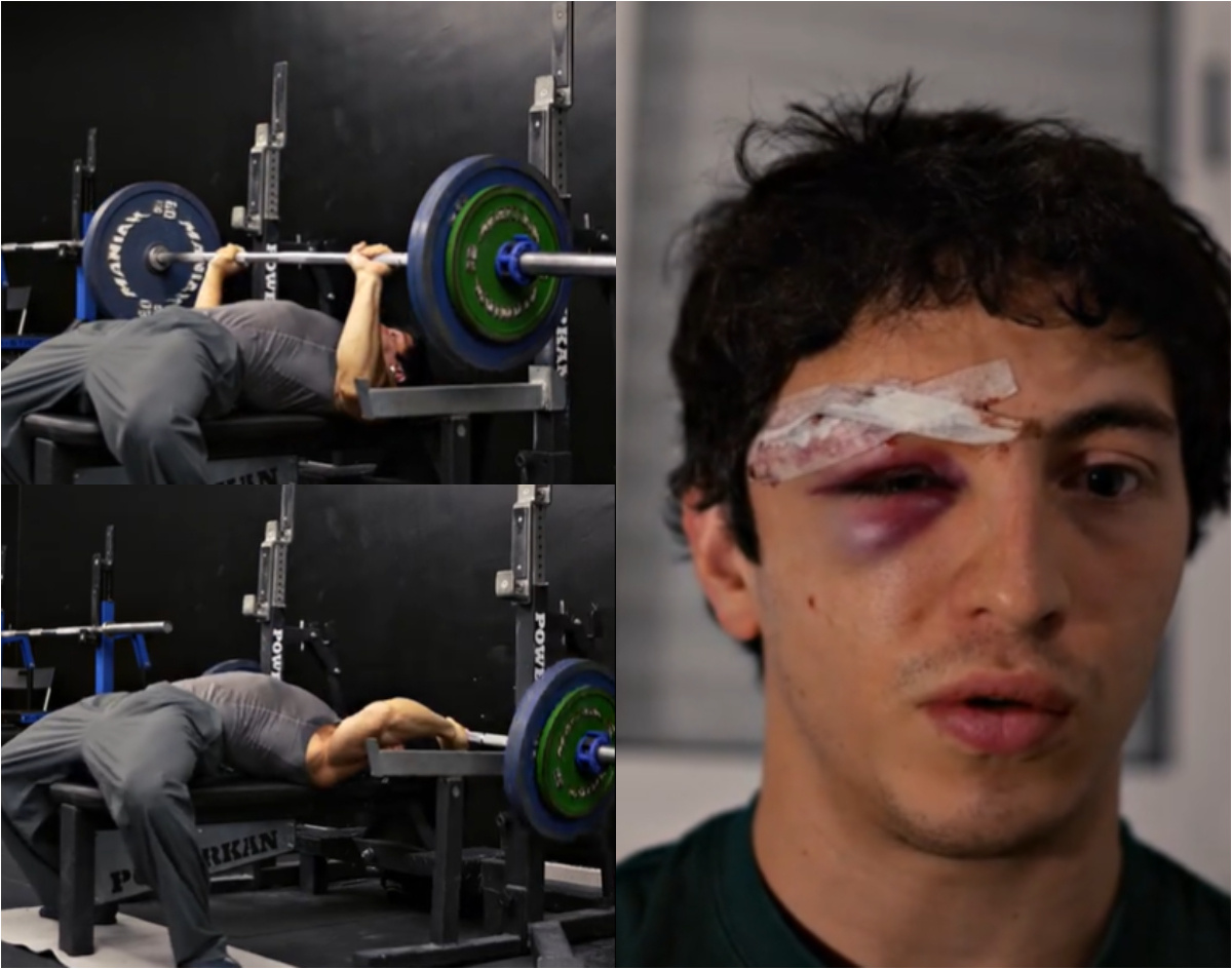 Impactante accidente en gimnasio: le cayeron 130 kilos en el rostro tras rebotar la barra