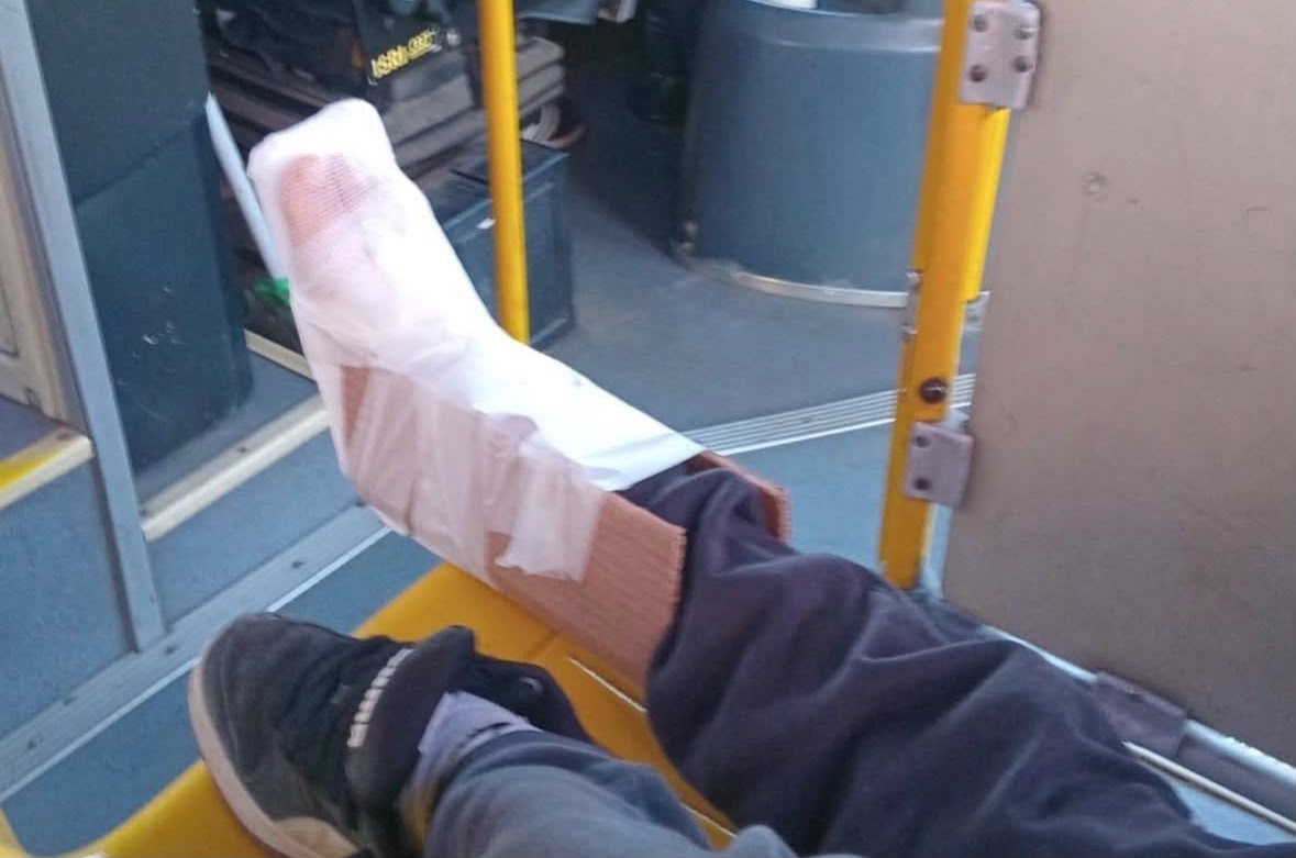 Indignación en Ciudad del Plata: inmovilizaron a niño con cartón y lo llevaron en ómnibus