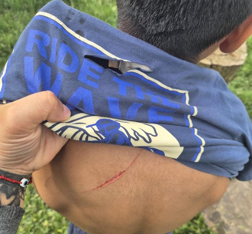 Violencia en una escuela de Salto: niña cortó la espalda de un compañero con una trinchera