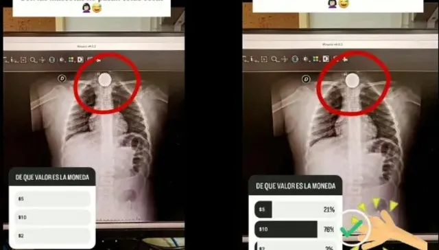 Una encuesta
