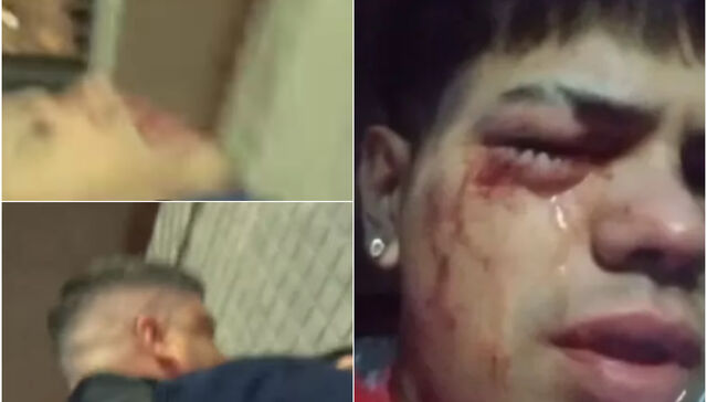 Policía denunciado por dejar ciego a un joven quedó grabado en otro episodio de violencia