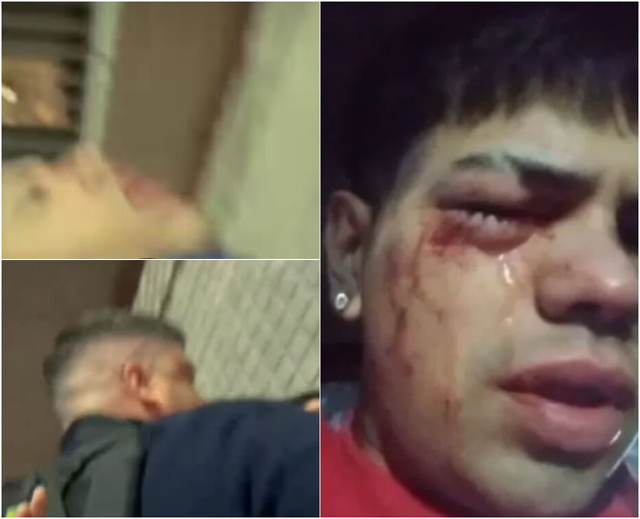 Policía denunciado por dejar ciego a un joven quedó grabado en otro episodio de violencia