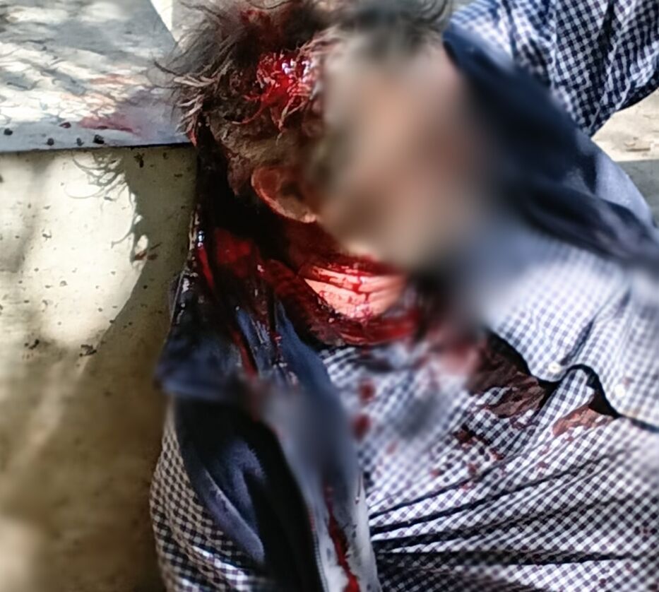 Abuelo defendió a su nieta de 5 años y seis hombres le dieron una brutal paliza a palazos